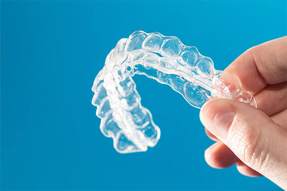 clear aligner