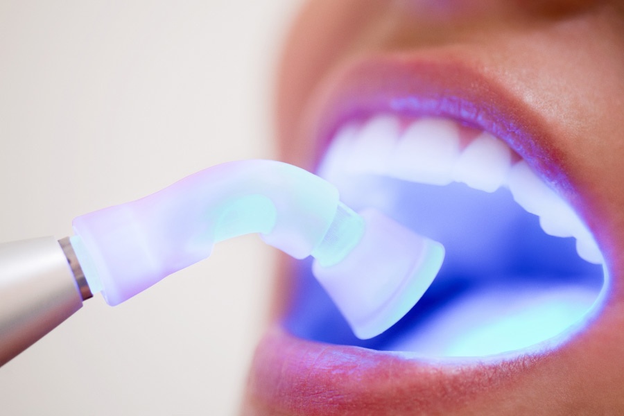 Blue light oral cancer screening.