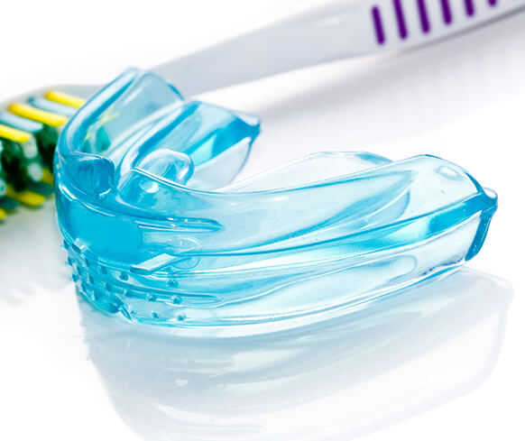 mouthguard next to a toothbrush