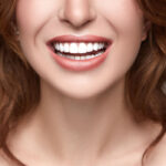 Close up of a woman's smile with straight, white teeth.