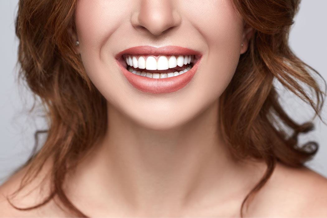 Close up of a woman's smile with straight, white teeth.